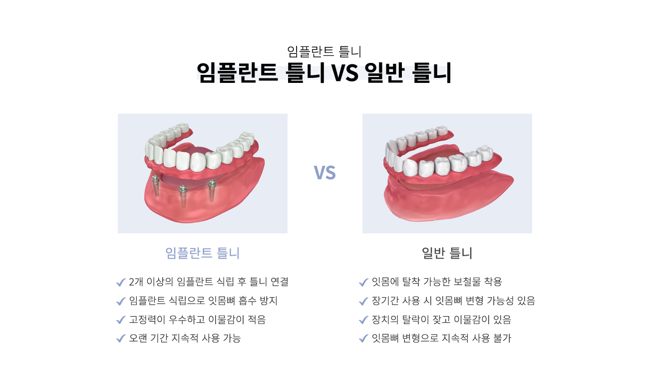 ���ö�ƮƲ�Ͽ� �Ϲ�Ʋ���� ������ ��