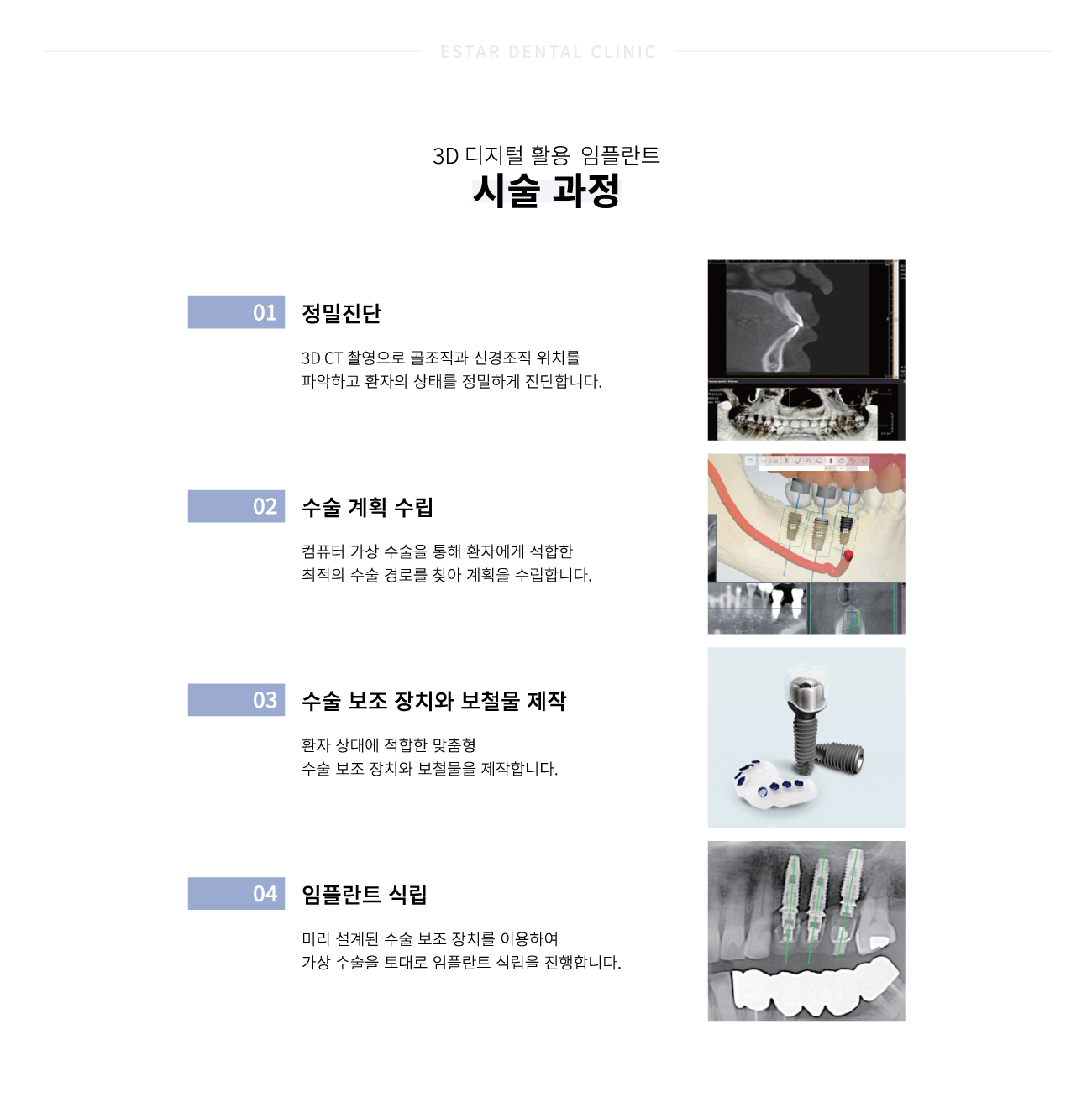 �׺���̼����ö�Ʈ �ü�����