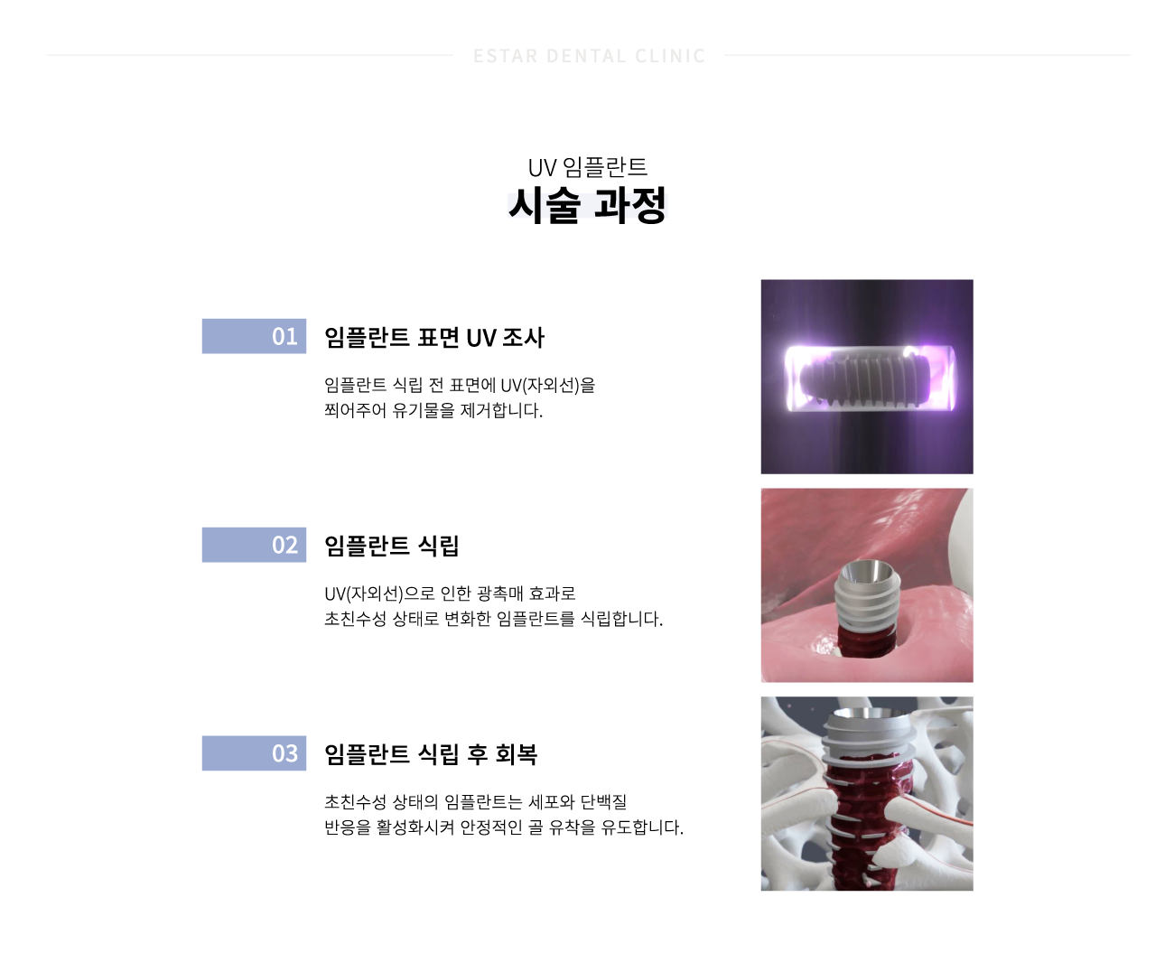 uv���ö�Ʈ �ü�����