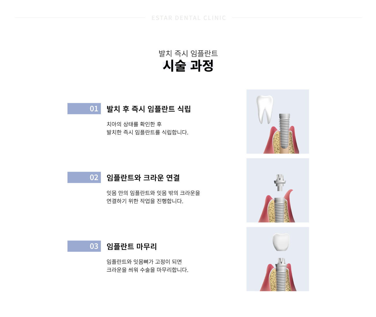 ��ġ������ö�Ʈ �ü�����