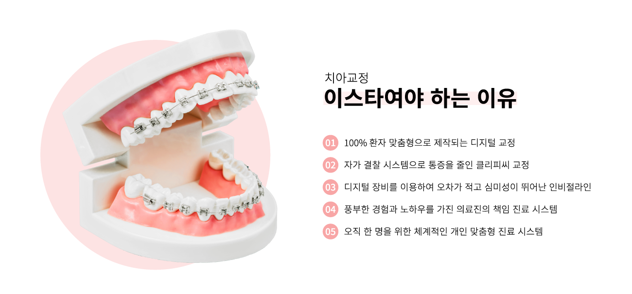 ġ�Ʊ��� �̽�Ÿ�����ϴ� ����