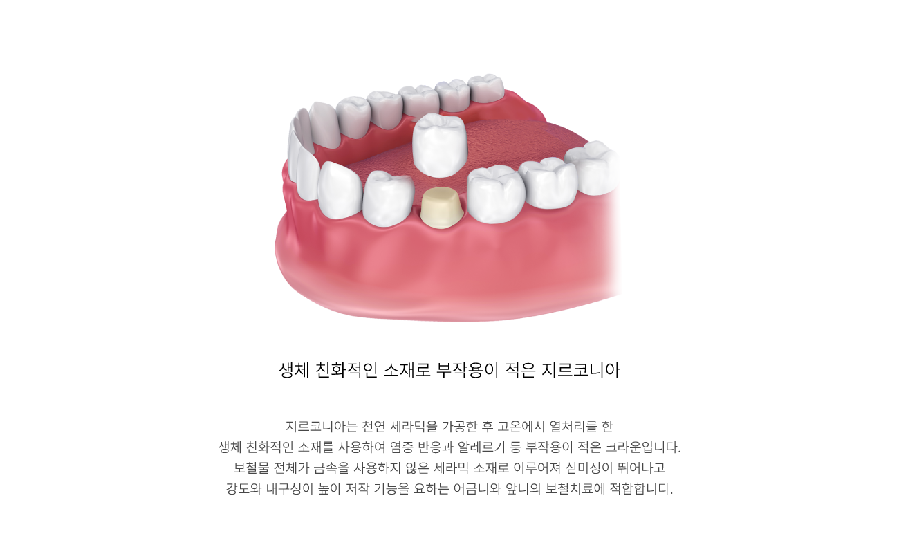 �����ڴϾ�