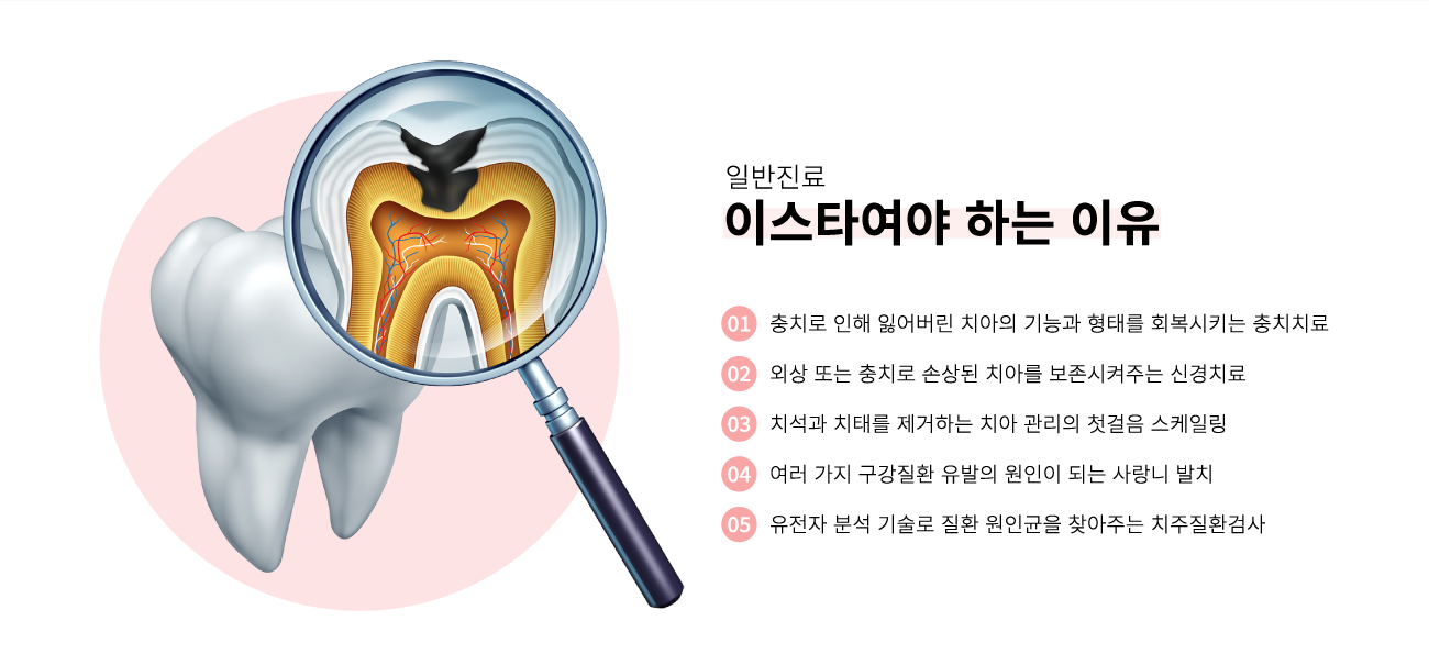 �Ϲ����� �̽�Ÿ�����ϴ� ����