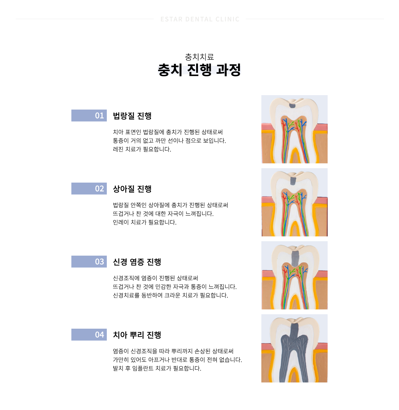 ��ġġ�� �ü�����