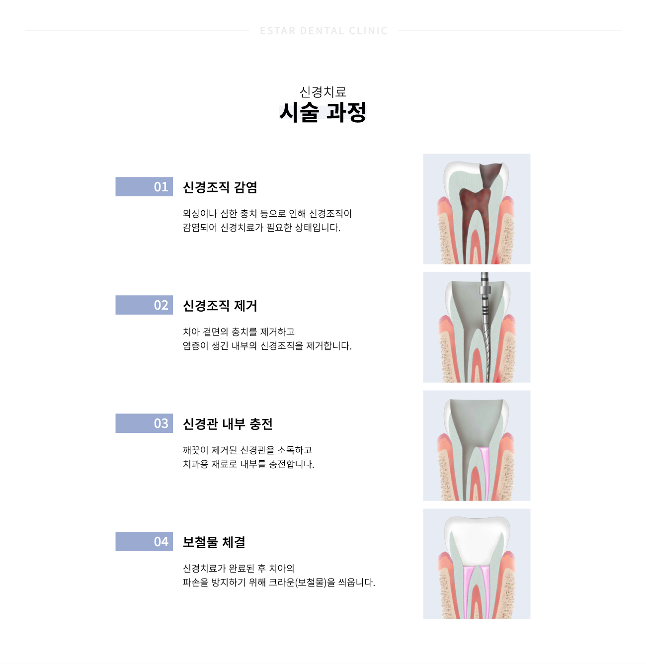 �Ű�ġ�� �ü�����