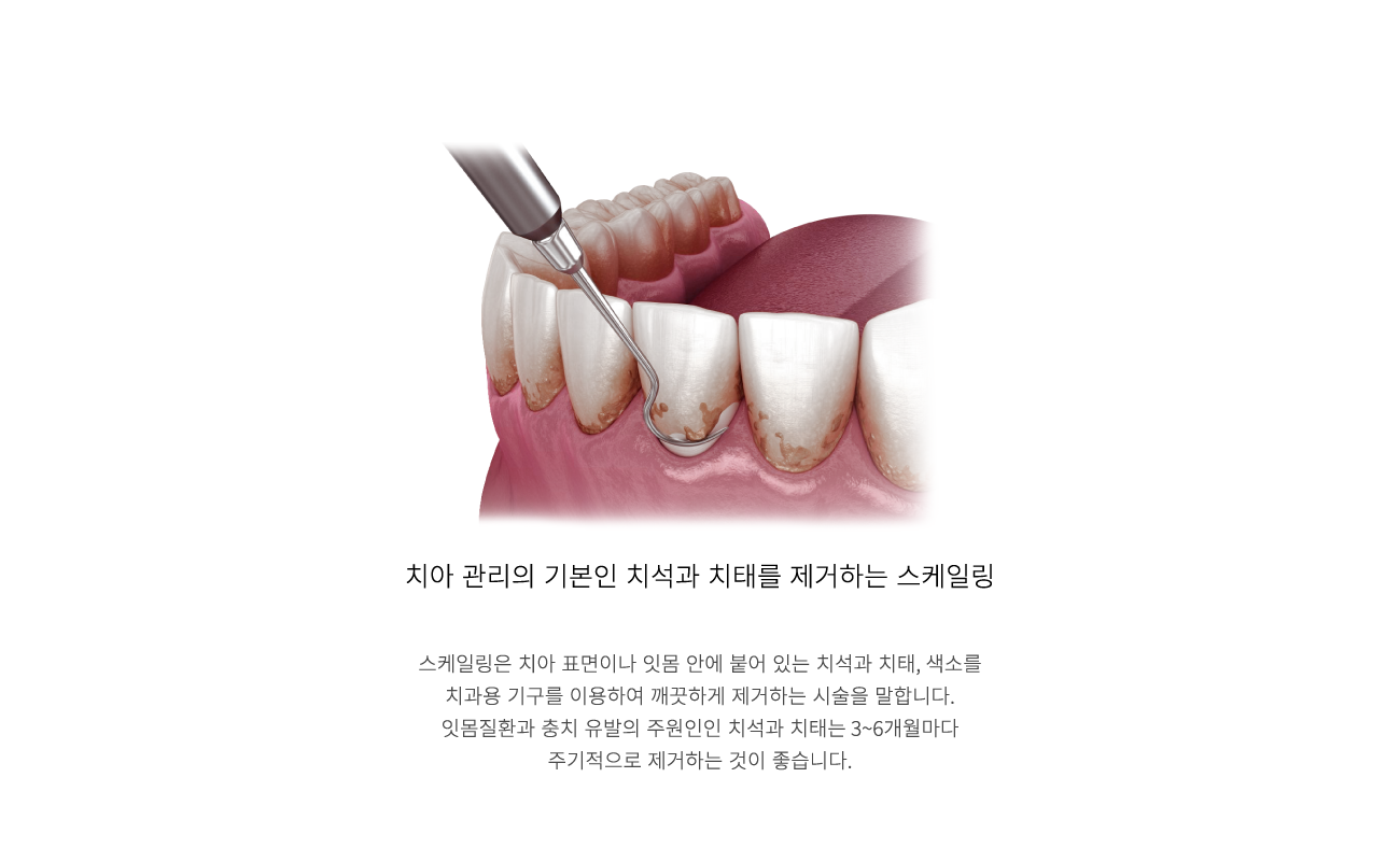 �����ϸ�