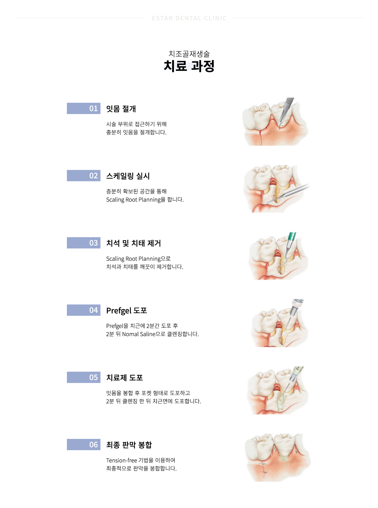 ġ��������� ����