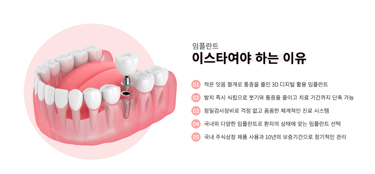 ���ö�Ʈ �̽�Ÿ�����ϴ� ����