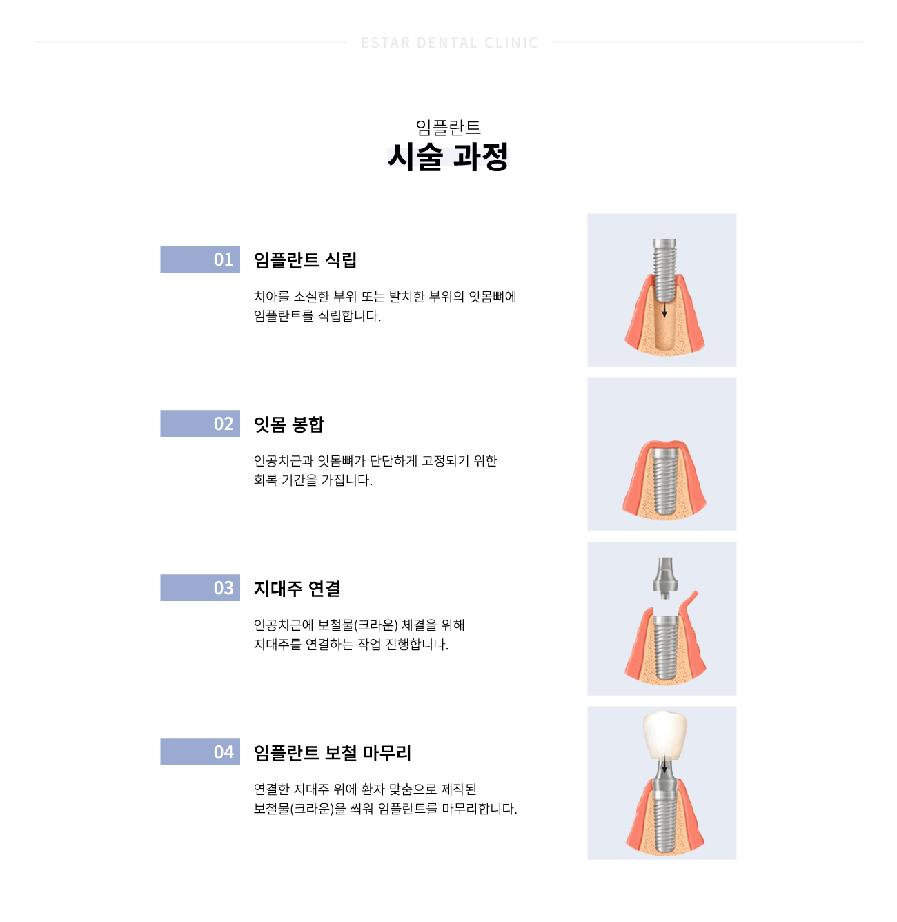 ���ö�Ʈ �ü�����