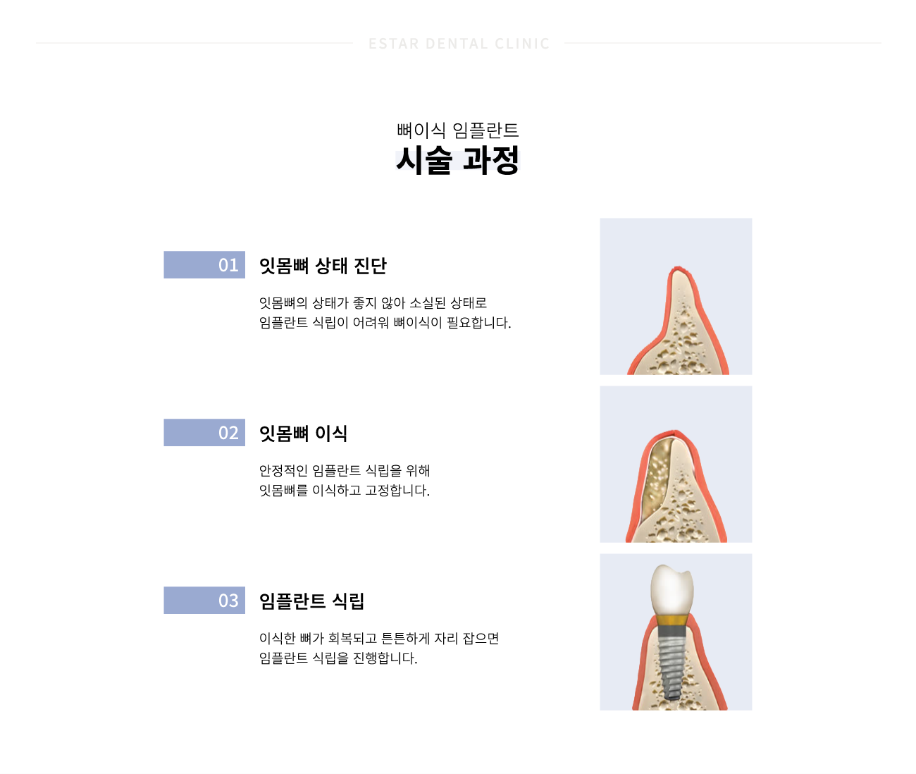 ���̽����ö�Ʈ �ü�����