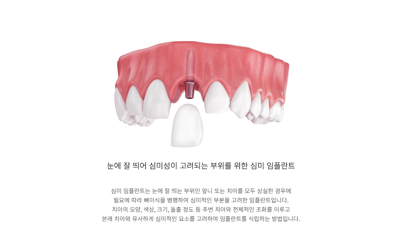 �ɹ����ö�Ʈ