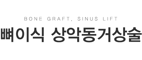 ���̽�, ��ǵ��Ż�� Ÿ��Ʋ