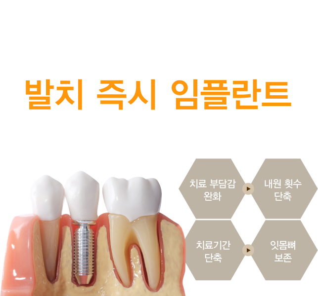 ��ġ������ö�Ʈ